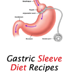 Visit our site http://t.co/H1UkAJi8IZ for more information on astric Sleeve Diet Plan.
