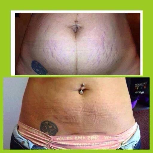 Im a stay at home mom of 3 and wanted to make money but stay at home with the kids too. Then i discovered 'itworks' and here i am.