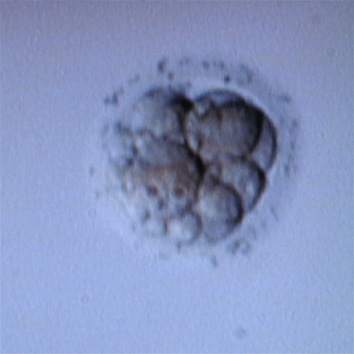 Dealing with Infertility