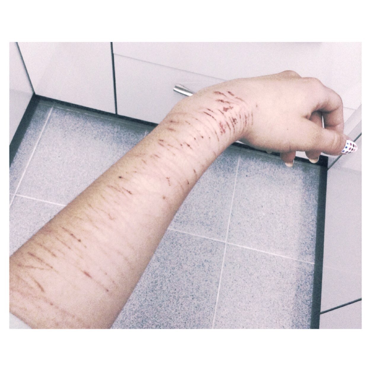 En 5 dias 14 años, acomplejada desde los 12. Botella de agua y cuchilla en mano. 43 k, pura mierda.