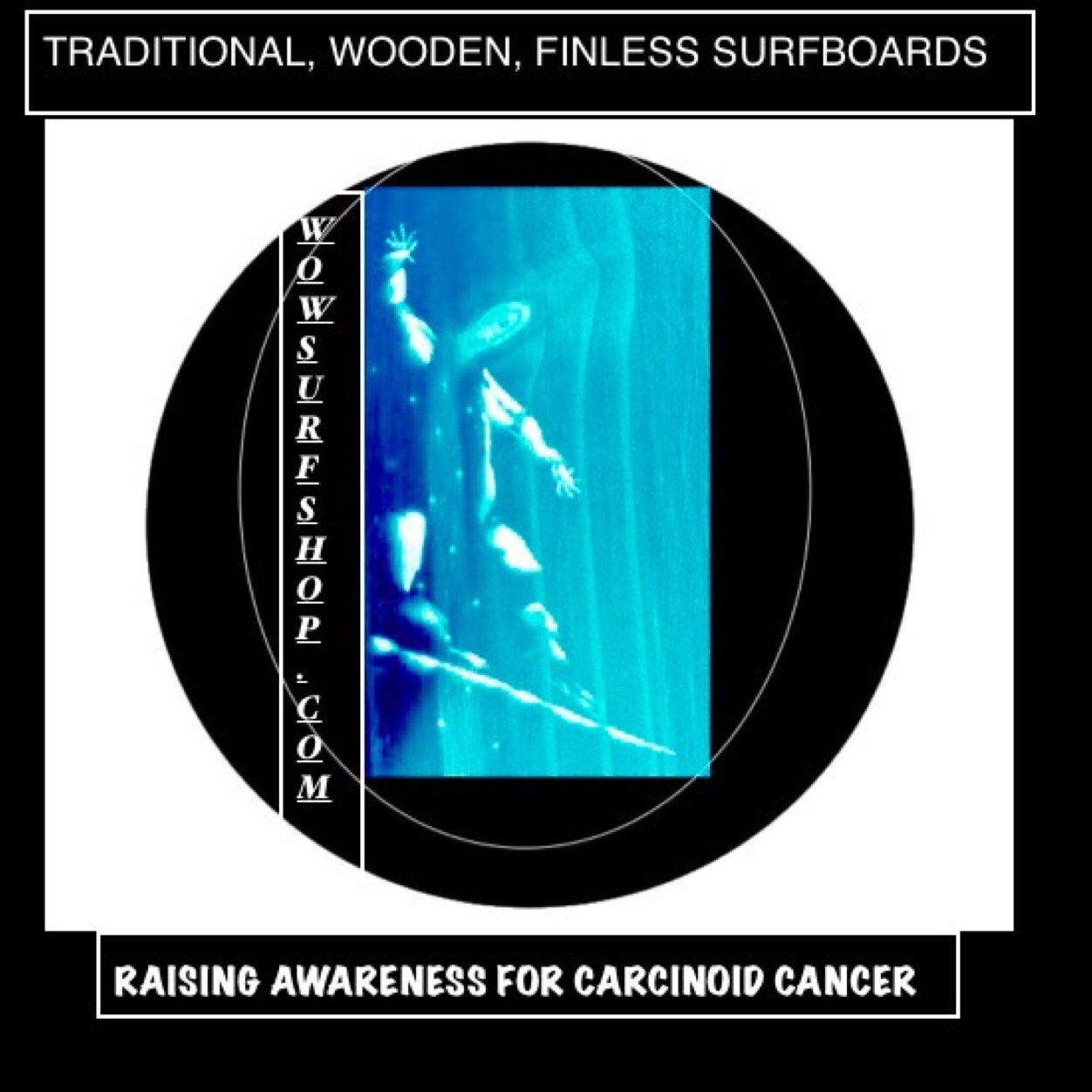 Alaias4Carcinoid Profile