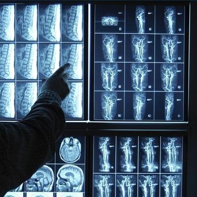 Let me help you to become a real radiologist.