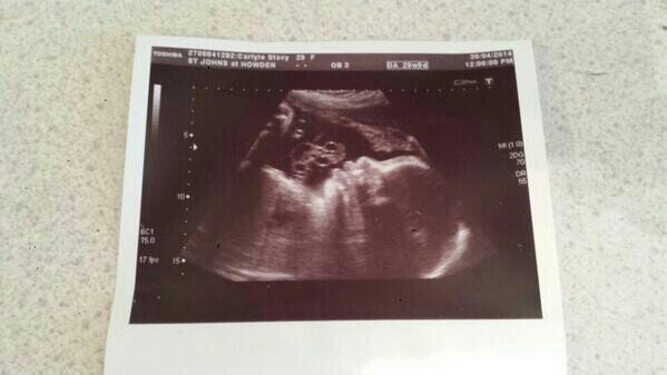 can't wait to meet my new princess so excited. #family1st.