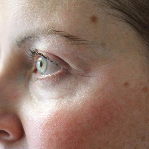 TopSecretSkin's profile picture. Top Secret Skin is the exclusive Aus & NZ distributor of the latest cold plasma technology from Italy. The new painless way to visibly reduce signs of ageing.