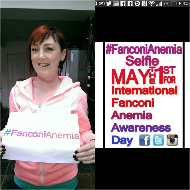 I have metastatic cancer & FA.It's a complex&chronic disorder & is a cancer-prone disease, affecting patients decades earlier than general population!