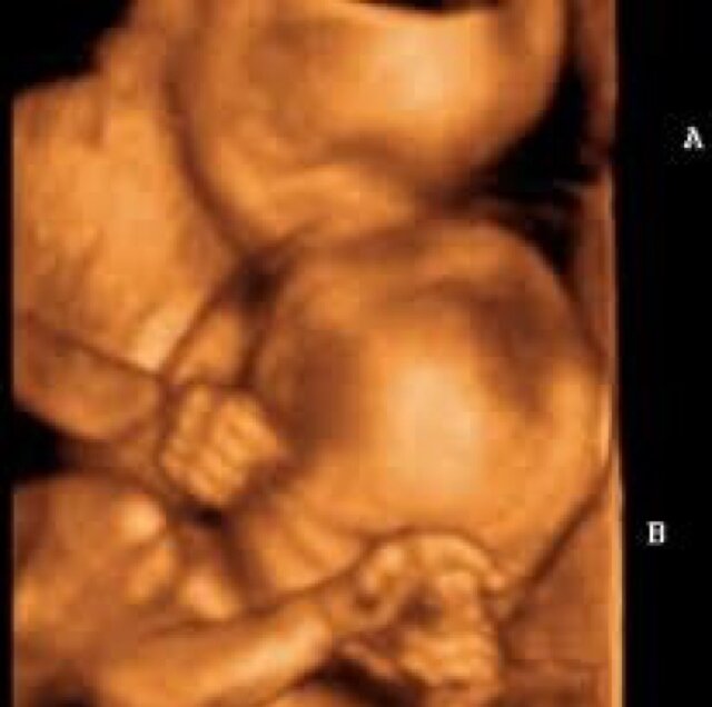 AmericasxDream's profile picture. Future daughter of @TheCap_America and @HisPeggyRogers . Twin Sister of @FutureSentinel