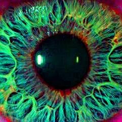 TeamIrisVision's profile picture. 