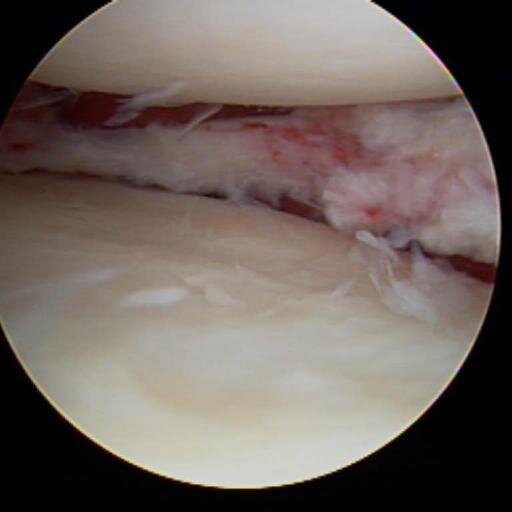 MEDICO ORTOPEDISTA ESPECIALISTA EN CIRUGIA ARTICULAR