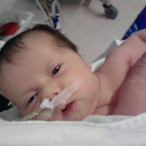 A Sofia nasceu com uma síndrome raríssima que impossibilita o funcionamento normal do intestino. Contamos com sua solidariedade para ajudá-la.