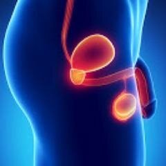 Endourologia, neurourologia, Criocirugia