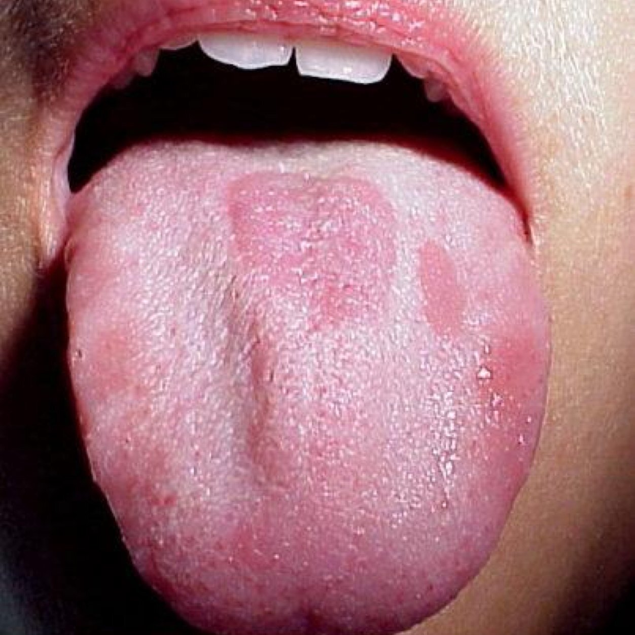 Diciendo mas de tres verdades, duelale a quien le duela... Sin pelos en la lengua