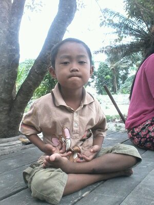 logi
