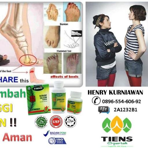 +62896 5546 0692 / PIN:2A1232B1 Obat Peninggi Badan, Obat Peninggi Badan Tiens, Obat Peninggi Badan Anak, Obat Peninggi Badan Tanpa Efek Samping
Add My LINE :