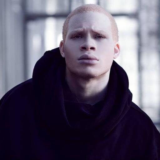 Albino Actors Photo Sir Maejor The World S Sexiest Albino Actor Model Albinos Sirmaejor Albinoactor Albinoactors Tropico Http T Co Dzzkeaejp4