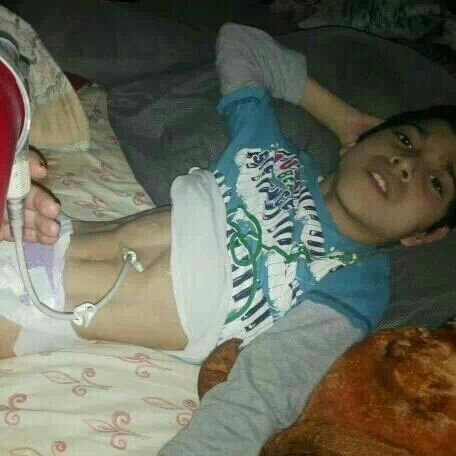 SAVE A CHILDS LIFE NOW! PLS HELP ME HELP MY 13 YEAR OLD SON FOR TREATMENT OF HIS CEREBAL PALSEY AND EPILEPSY SICKNESS