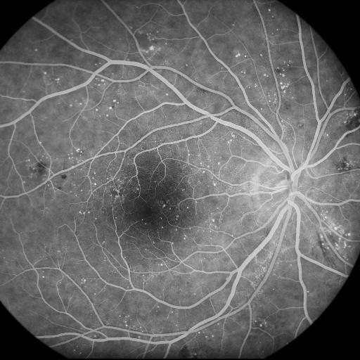 digital retinal imaging upgrades and pre-owned fundus cameras and slit lamps