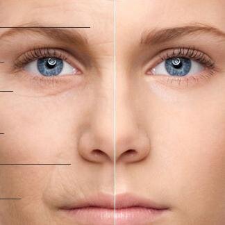 Phyto-Renew 350′s all natural plant-based ingredients, you can now slow down and prevent the signs of aging!