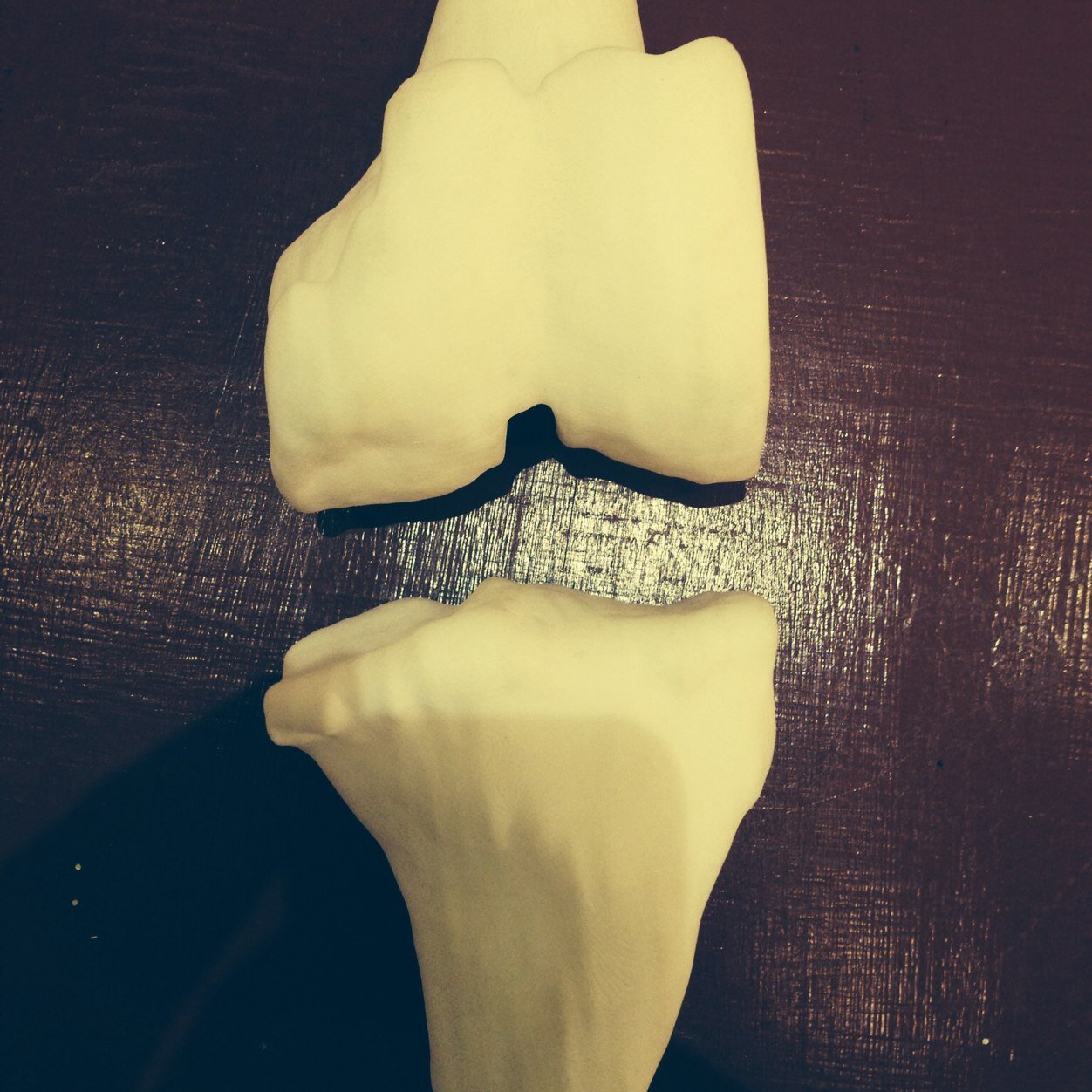 Knees_Hips's profile picture. Consultant Orthopaedic Surgeon specialising in Knee and Hip Surgery. Info@boneandjointcentre.com