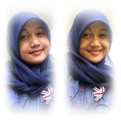 STIKes BN Subang-Analis Kesehatan