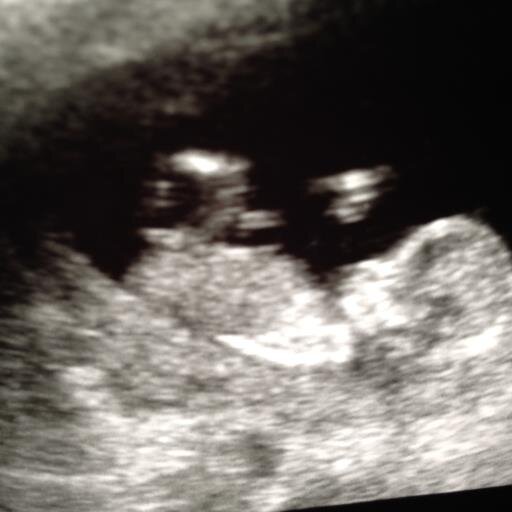 ninjafish007's profile picture. 