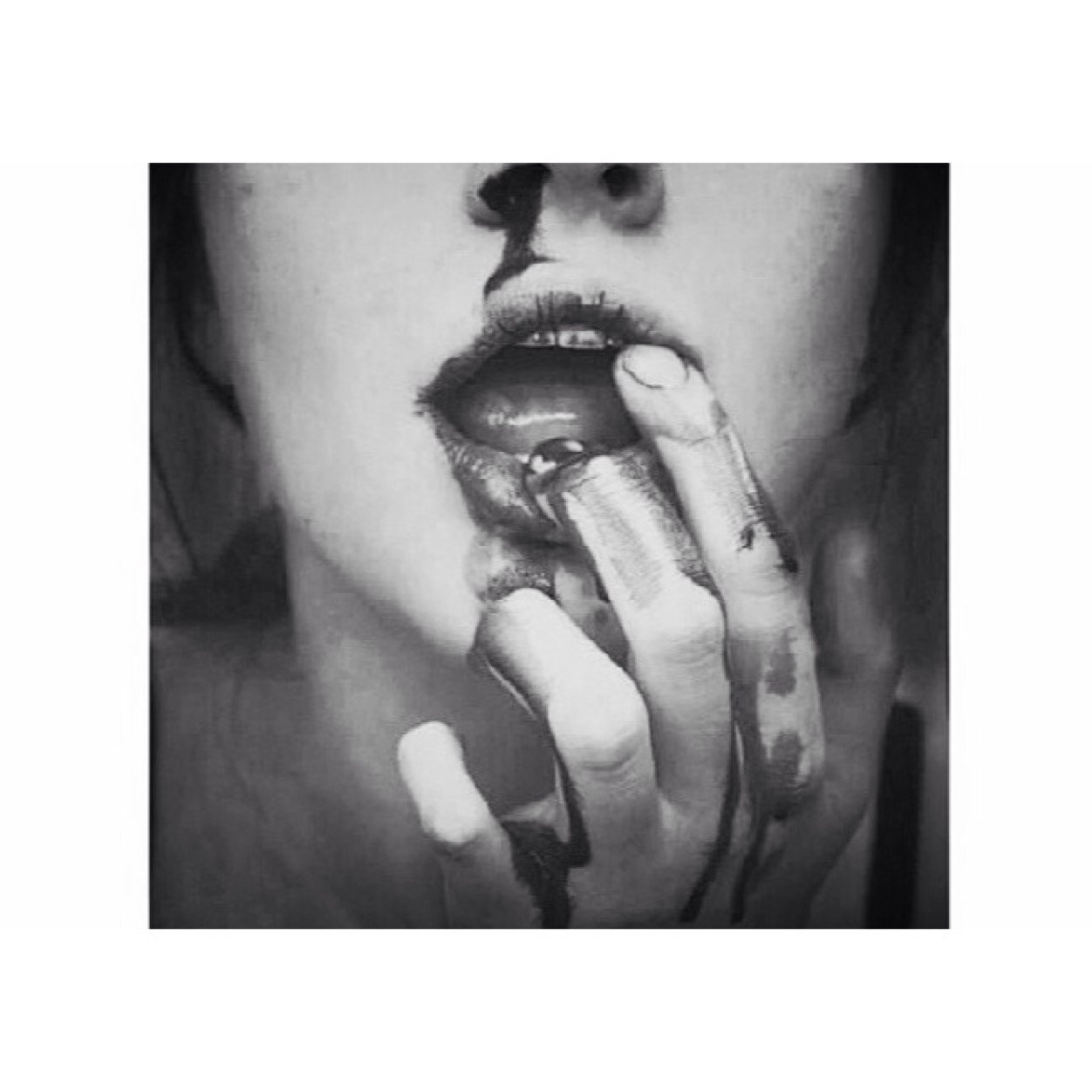depression. anxiety. bullimia. suicide. dermatillomania. self harm.