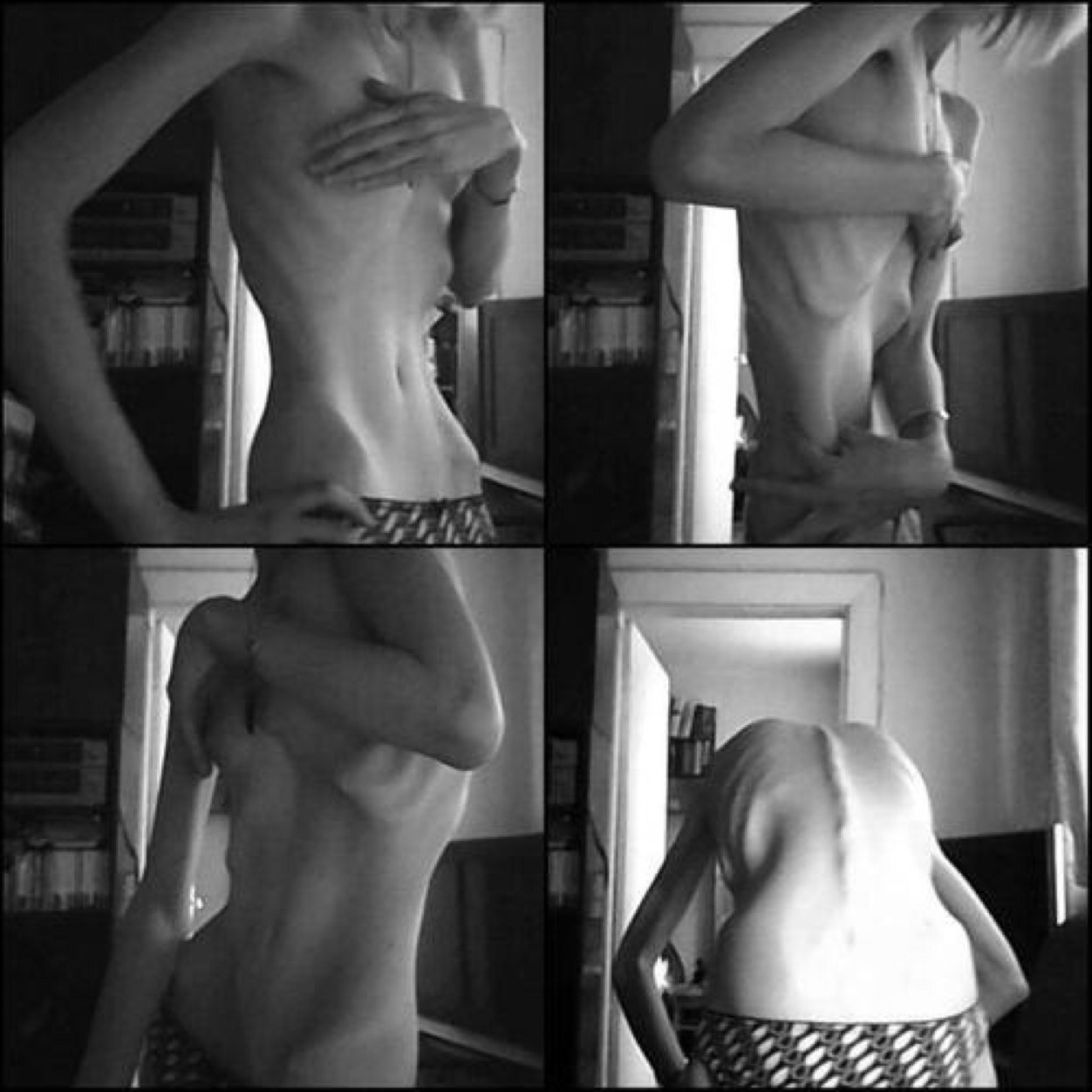 Skinnnandbones's profile picture. I just want to be able to see all 206 bones