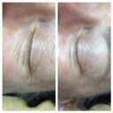 ForeverYoungSkincare - @NanceJackGarber - Twitter