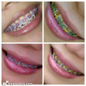 maharanionline1's profile picture. Maharanisalon_parahyangan.beauty&body care|sulam alis+bibir|tatto hena+weding|nail art+extantion|softlens|hairclip,hrg grosir|behel+gigi tiruan.