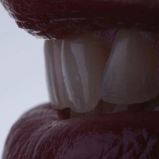 conometriche's profile picture. soluzioni protesiche gerontoiatriche, sia su protesi implantologiche, che su protesi ad appoggio misto