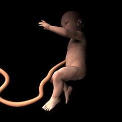 United for anatomical integrity. Against cutting. Against clamping. Against parental hegemony. Umbilical cords are shared - not owned. Babies have rights!