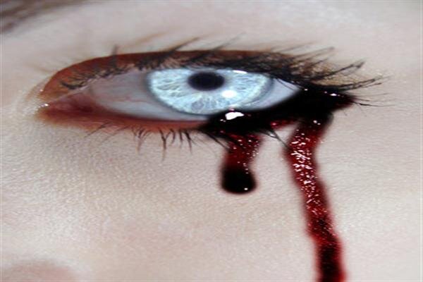 Tratem-me como estou por dentro: morta.