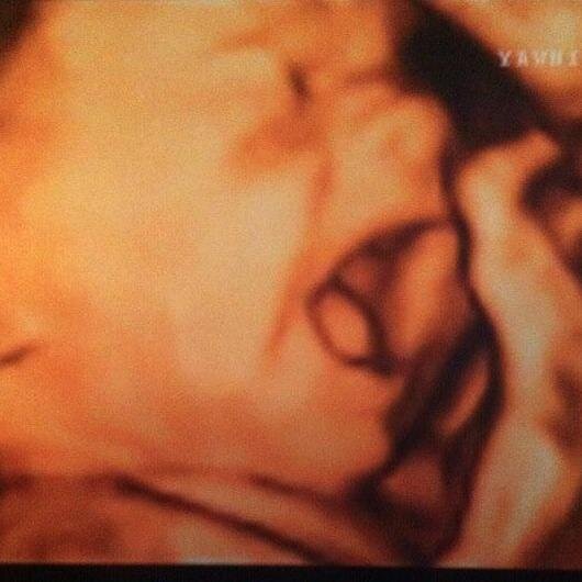Baby's Image in 3D is a 3D/4D ultrasound studio serving Michigan. Come meet your baby in 3D. Genders determined as early as 15 weeks!