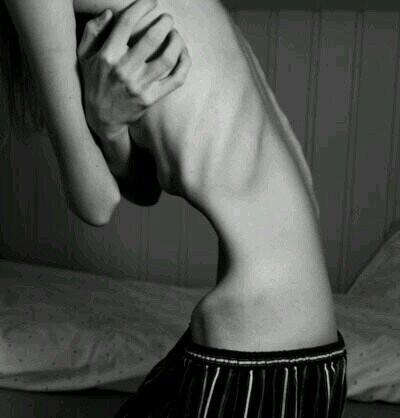 los montruos no estan debajo de mi cama. estan en mi cabeza en forma prejuicios. anorexia nerviosa , depresion, y 8 intentos de suicidios.