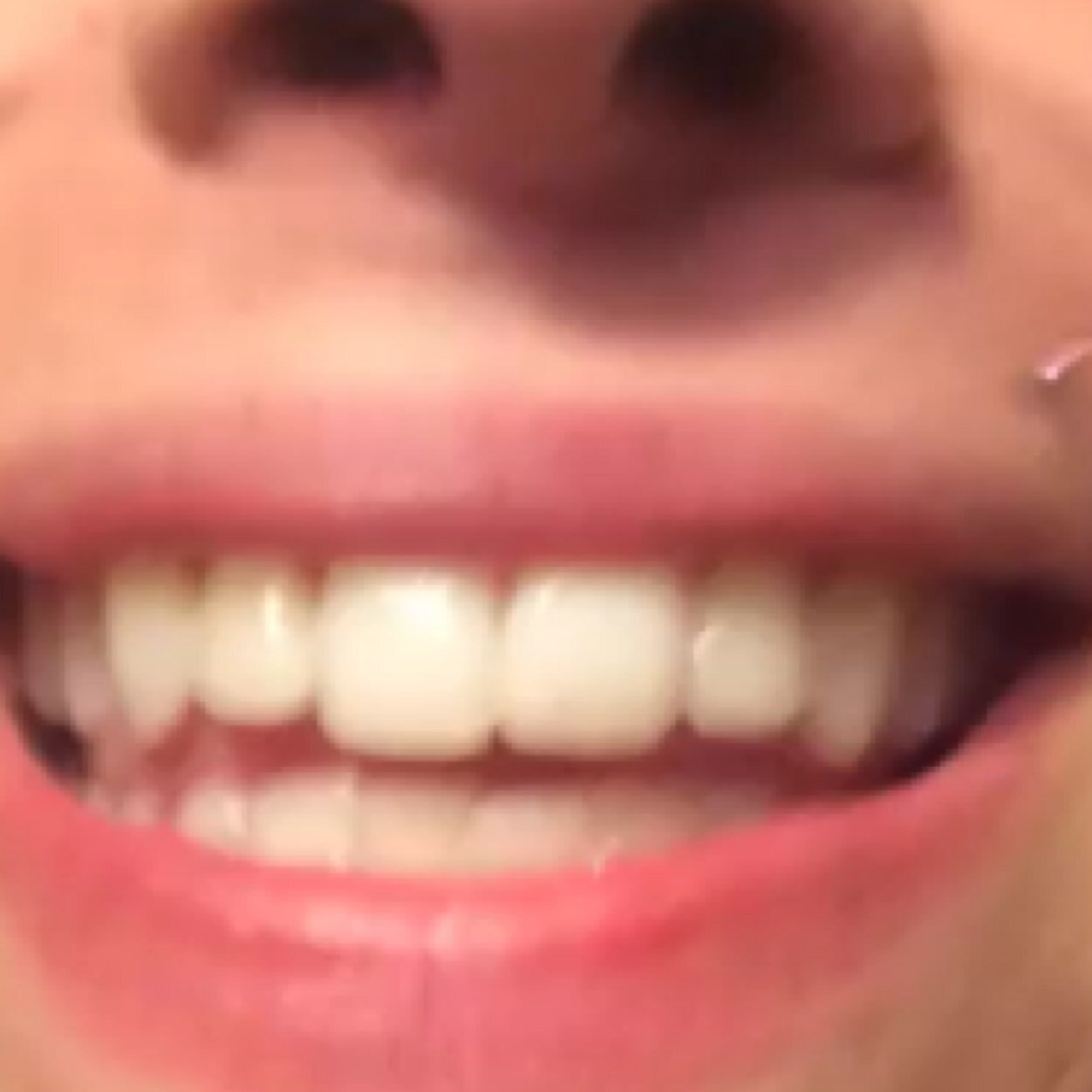 hi im alex's teeth yall