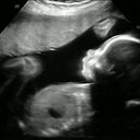 Alice Simmons - @_FutureSimmons - Twitter