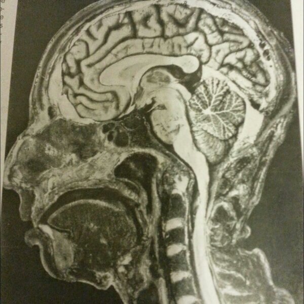 mariangian5's profile picture. médico psiquiatra - bicicleta - correr