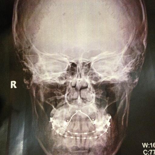 baskakimseyok's profile picture. dream machine