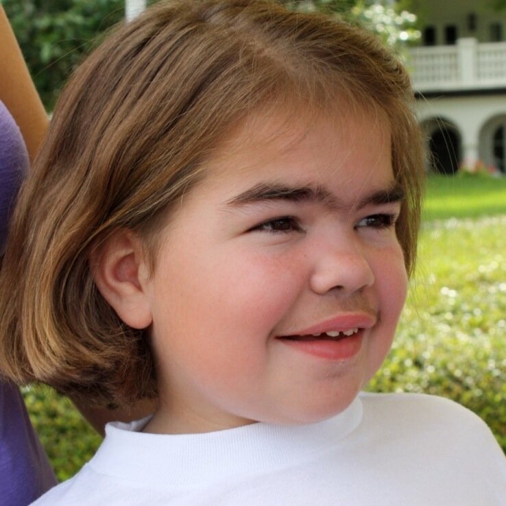 Blair has Sanfilippo Syndrome.  Sing for Blair, Fund a Cure is an effort to beat the clock and find a cure for her terminal illness.  We are close.