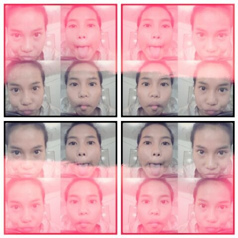Hipersomnia