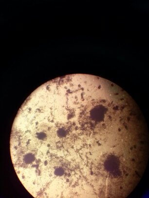 La Microbiología es una Ciencia que estudia organismos microscópicos y la influencia de sus actividades en el hombre, animales y el medio Ambiente