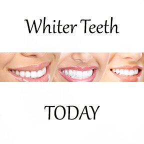 Affordable & professional high quality cosmetic teeth whitening. The beautiful smile you always wanted is just minutes away!