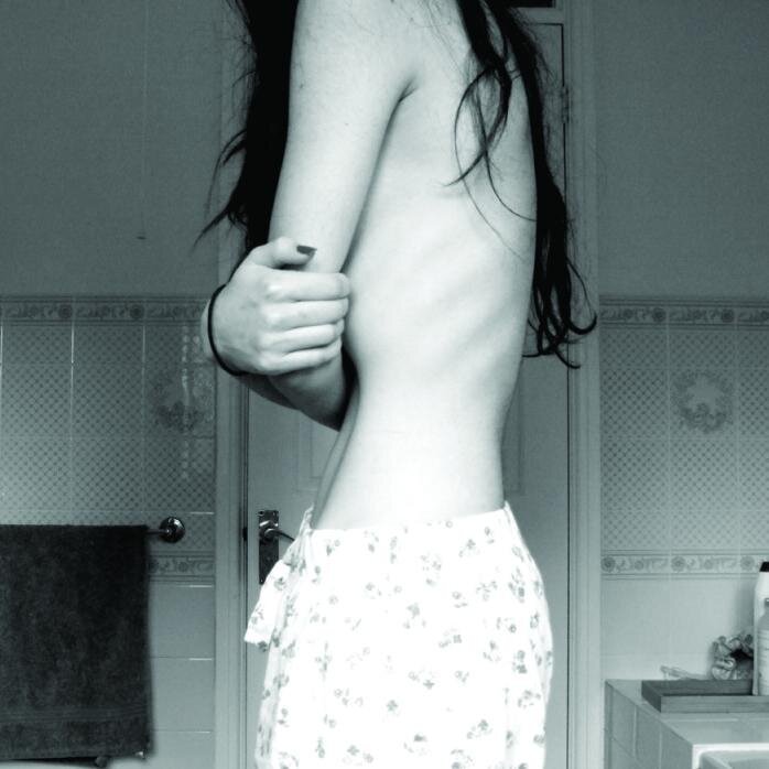 Gorda, depresiva, fea. #MiVidaEsUnaMierda