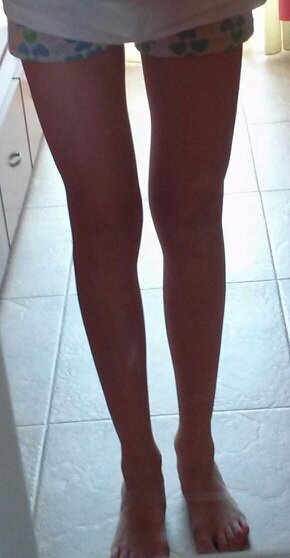 Normal hasta que descubrí que vomitar y cortarse era mejor que comer y sufrir.|1'69cm y 45'200kg|Meta 38kg| I am only.