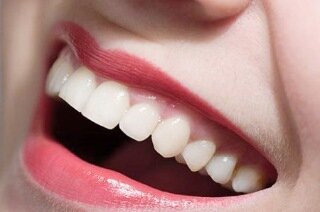 Saycheeze22's profile picture. For £25.00 I supply Polanight home teeth whitening kits with free delivery in the UK. Dentist approved teeth whitening.