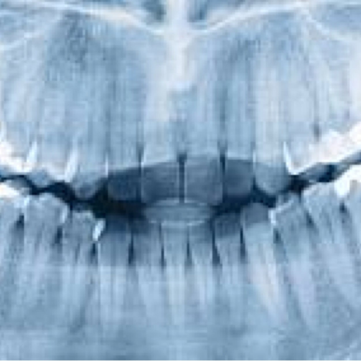 DentalTalks's profile picture. #Dentistry #Odontología #Oral Hygiene #Higiene bucodental Dental ideas worth spreading.....