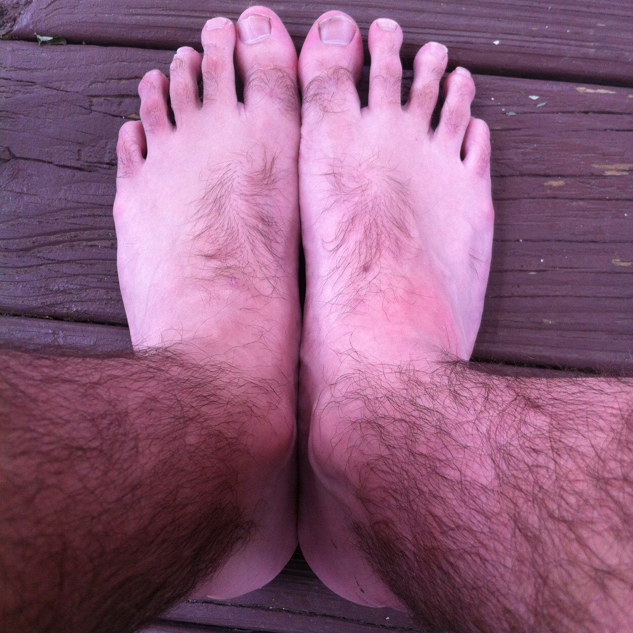 Lets take time to appreciate my hairy feet
