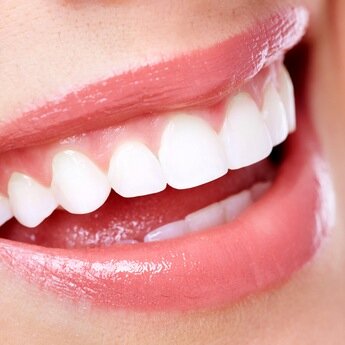 Straight white teeth for a confident smile. Options for adults & children inc white & Damon braces, Invisalign Tel 01642 243080 http://www.clevelandorthodontics
