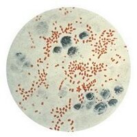 Visual Plague/ Global War Against the Rat (@visualplague) 's Twitter Profile
