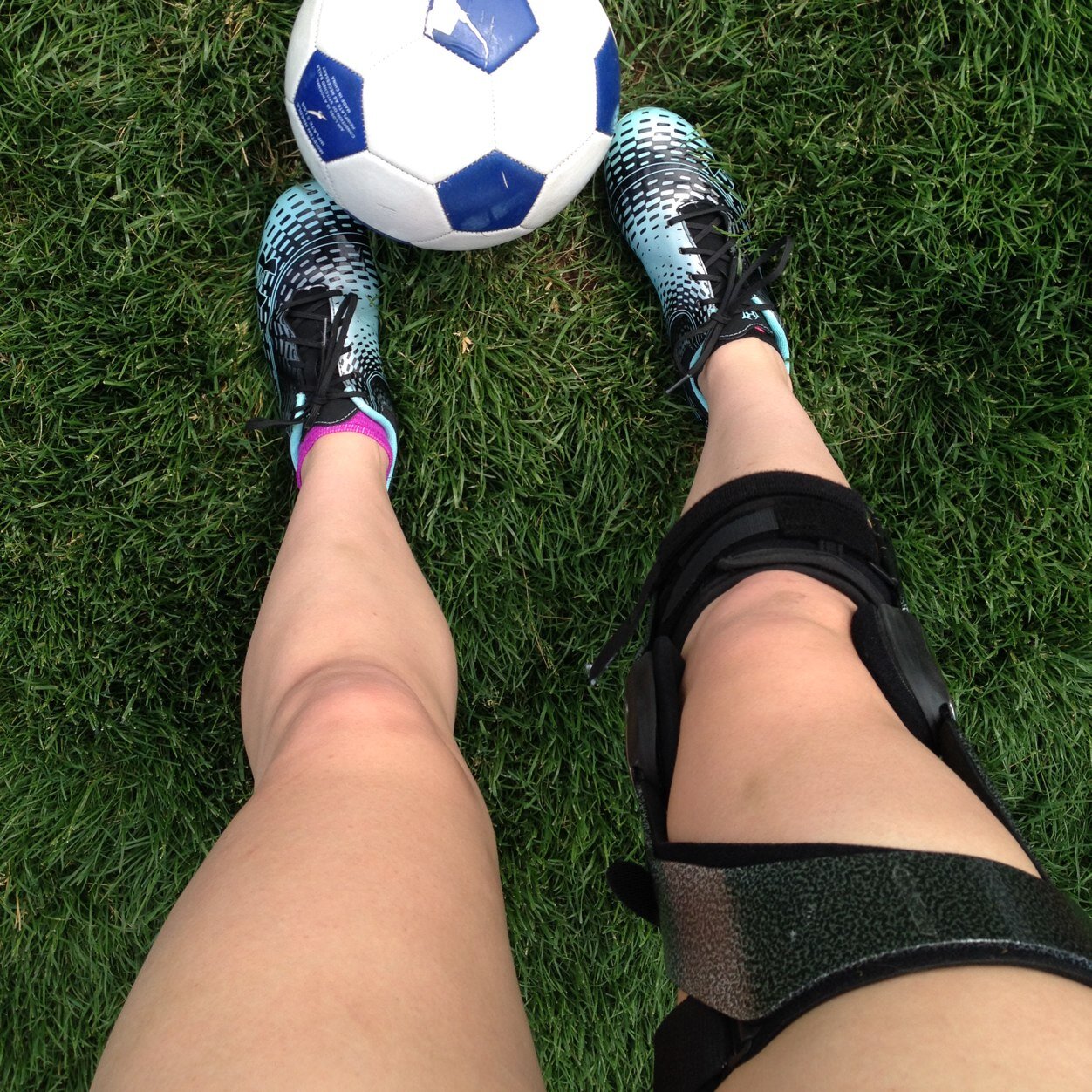 ACL_Terror's profile picture. torn acl and medial meniscus on the road to recovery.