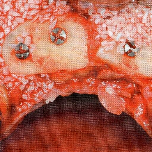 Biomateriais.